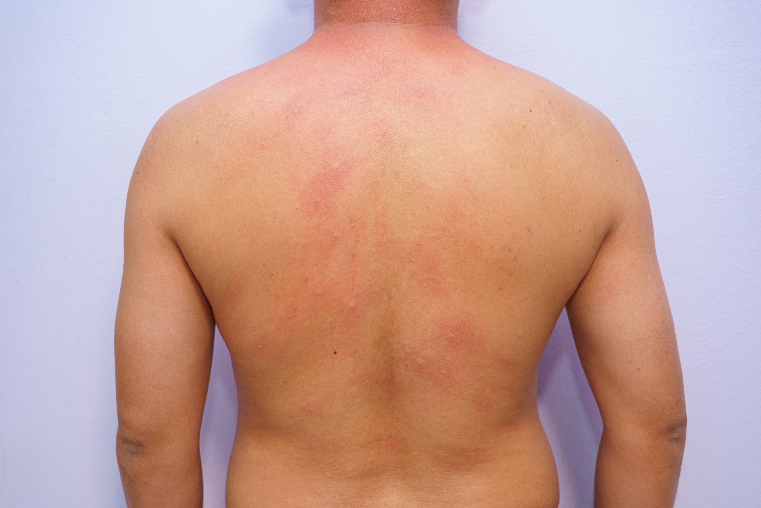 Faklis, Tallis & Mead - Chicago Vaccine Injury Case Lawyers